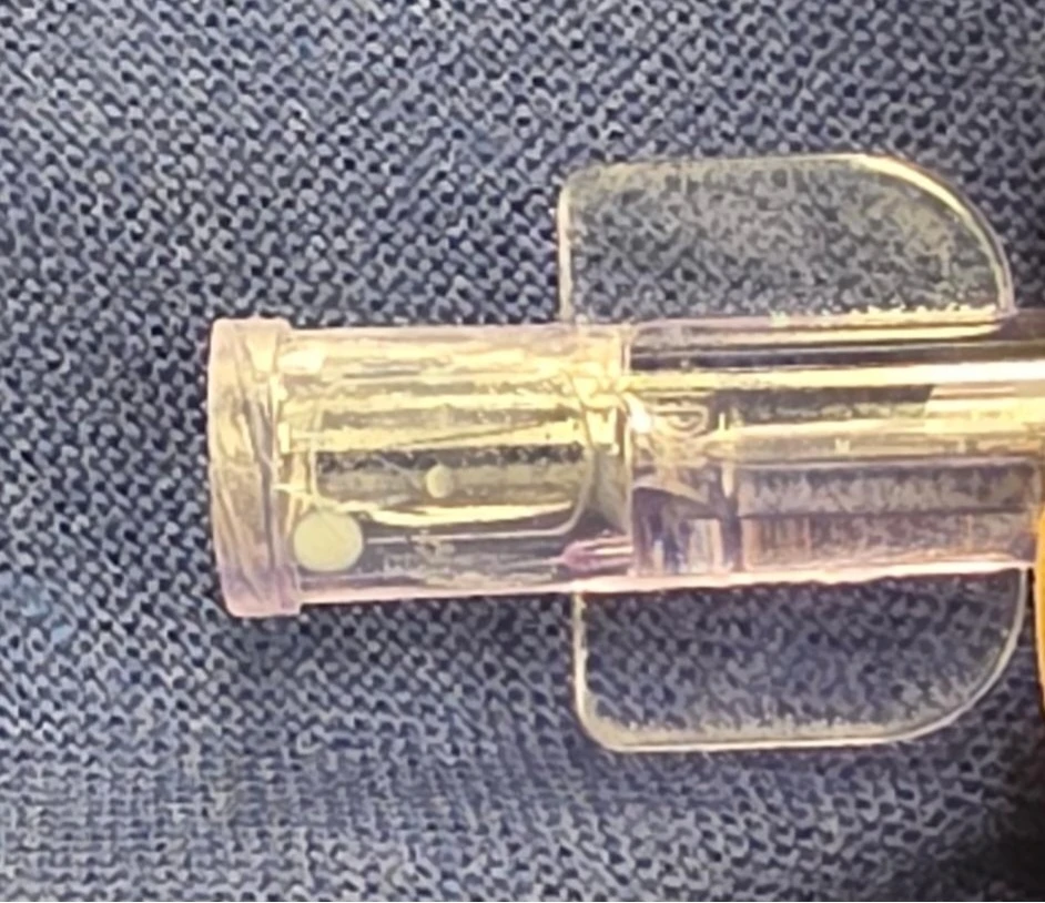 Propofol leakage close up